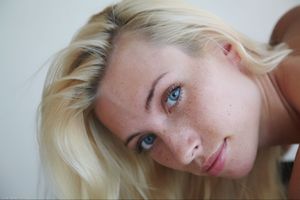 Adele.Lentigginoso d7aiblc1sf